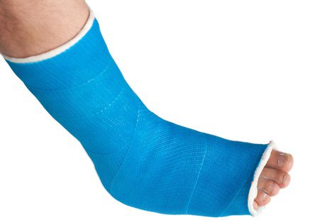 How Much Compensation Can I Claim For A Foot Injury Free Legal Advice