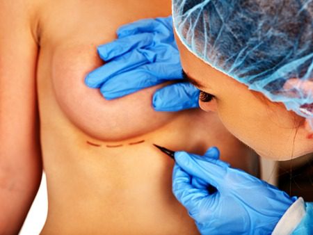 Breast Augmentation Enlargement Negligence Claims