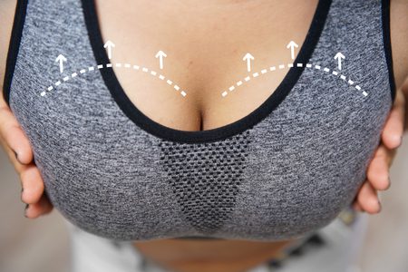 How To Claim For Botched Breast Reduction Surgery