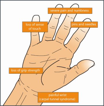 symptoms of hand arm vibration - Free Legal Advice