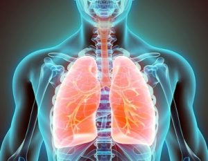 Pneumoconiosis compensation claim guide