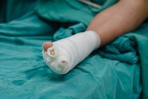 A foot wrapped in bandages post toe amputation