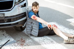 An injured person sitting on the road and against their car. They have a bloodied elbow, hand and knee.