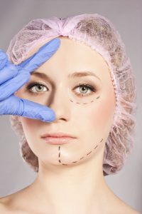 A woman has cosmetic procedure marks drawn on her face. 