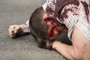 A man lays on the road with a head injury following a serious road accident. 