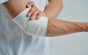 A man with an elbow tendon injury.