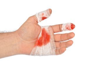 An image shows an bloody and bandaged hand.