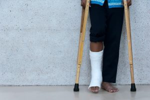 Man with right leg in plaster cast stands upright on wooden crutches.