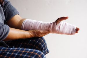 A man with a broken arm wrapped in white bandages